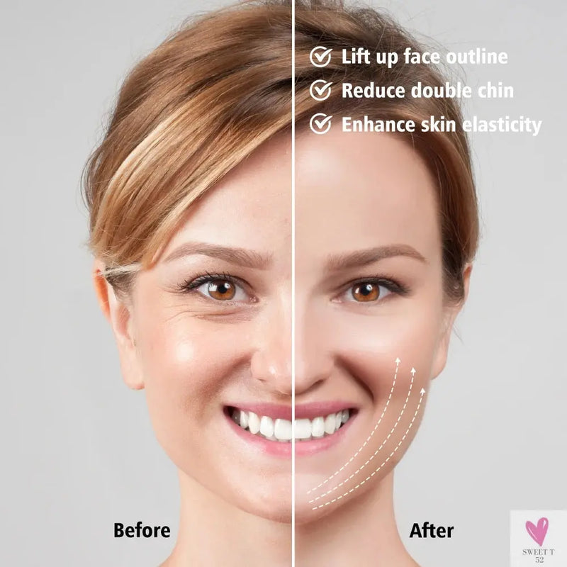 Face Lifter V-Line Belt - 5 Modes LED Photon Therapy, Face Slimming Vibration, and Massager-Beauty-SWEET T 52