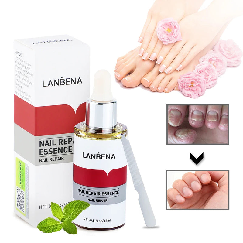 LANBENA 15ml Nail Repair Essence Serum Anti Infection Paronychia Onychomycosis Treatment Foot Care Nail Fungus Removal Gel Sweet T 52