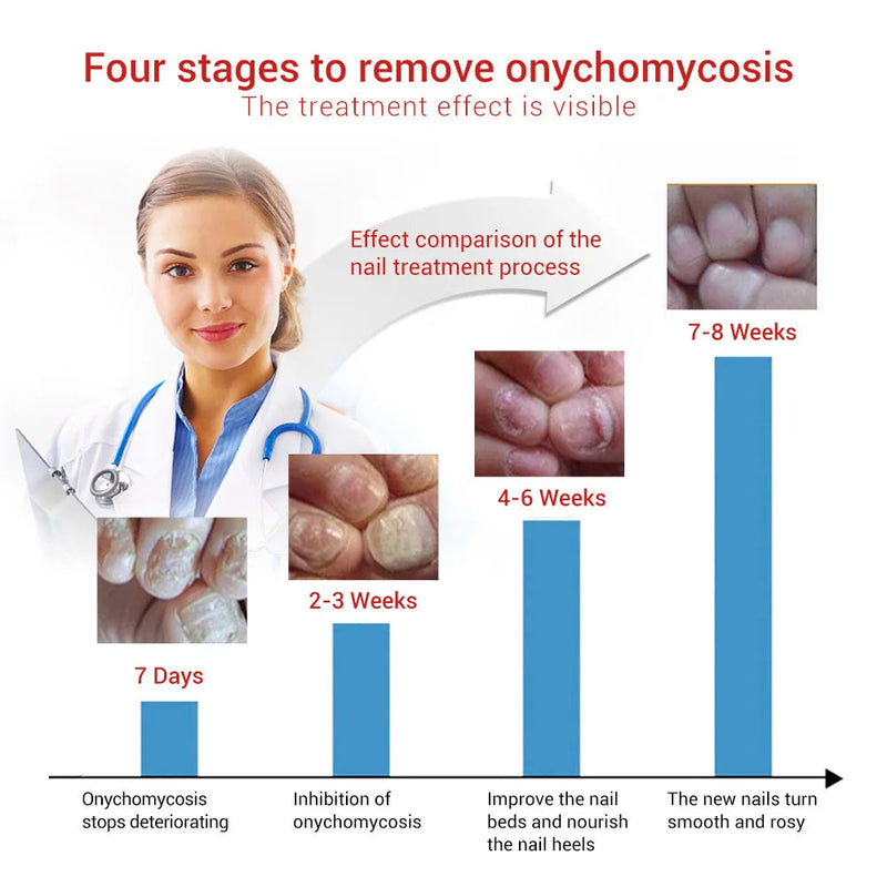LANBENA 15ml Nail Repair Essence Serum Anti Infection Paronychia Onychomycosis Treatment Foot Care Nail Fungus Removal Gel Sweet T 52