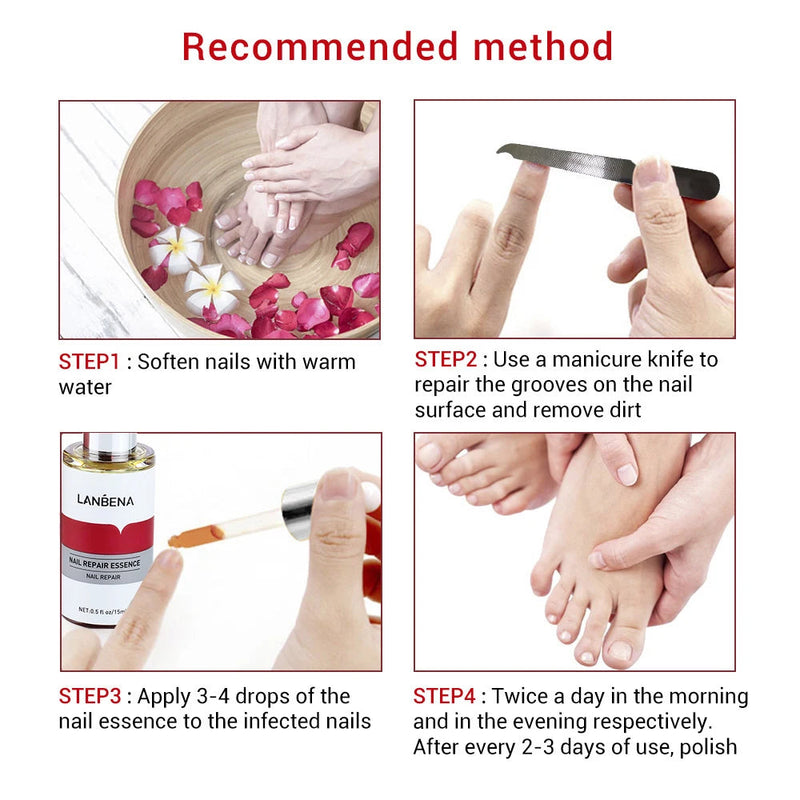 LANBENA 15ml Nail Repair Essence Serum Anti Infection Paronychia Onychomycosis Treatment Foot Care Nail Fungus Removal Gel Sweet T 52