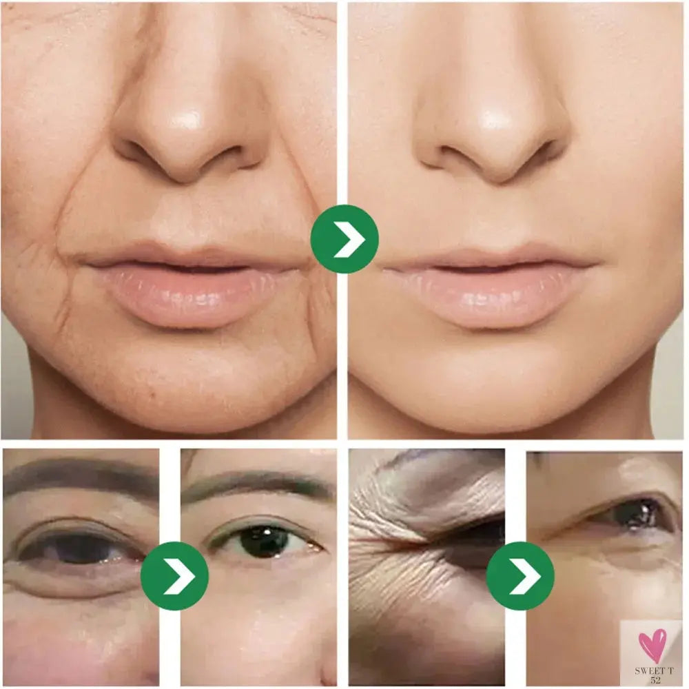 Six peptides Japanese Cream - Anti-Wrinkle Moisturizing, Anti-Early Aging for Sensitive Skin Face And Neck, Unisex-cosmetic-SWEET T 52